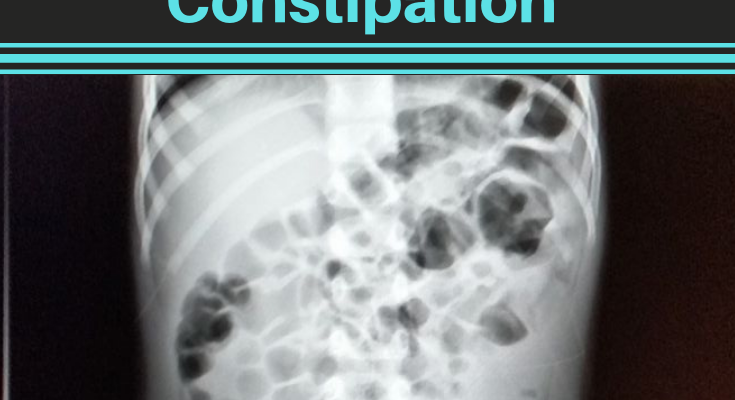 severe constipation after colonoscopy